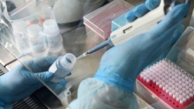 ФНС и Минфин дали официальное разъяснение по поводу учета расходов на тестирование работников на коронавирус